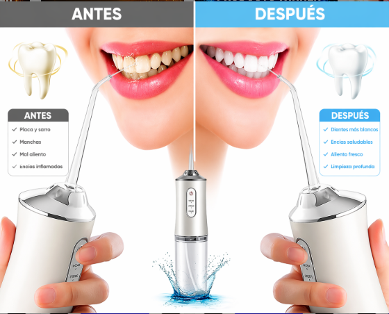 🔥 IRRIGADOR DENTAL PRO – LIMPIEZA PROFUNDA EN SEGUNDOS 💎